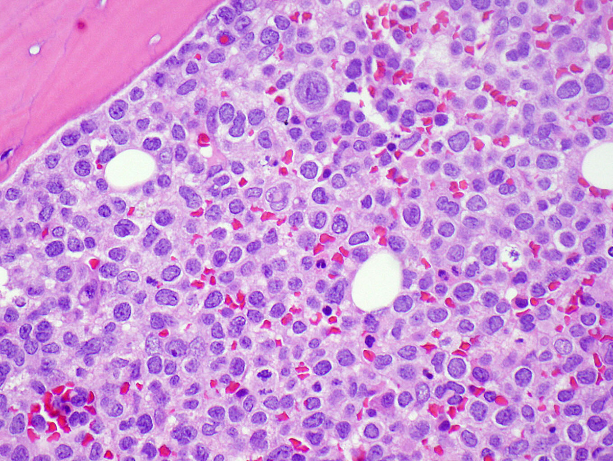High power image of the primitive cells (H&E)